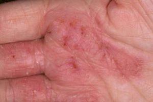 Определяем болезни по рукам: если ладони красные - барахлит печень, мокрые - проблемы с гормонами